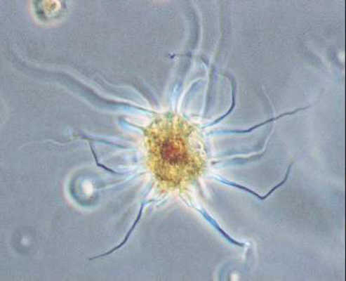 Amoebic Pfiesteria
